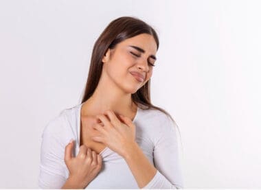Young woman scratching her neck due to itchy psoriasis